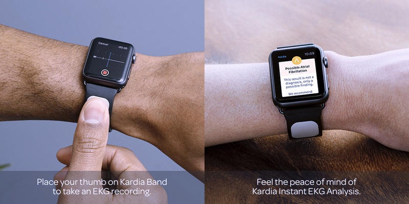Apple Watch的第一个心电图医疗配件，终获FDA批准-微刊